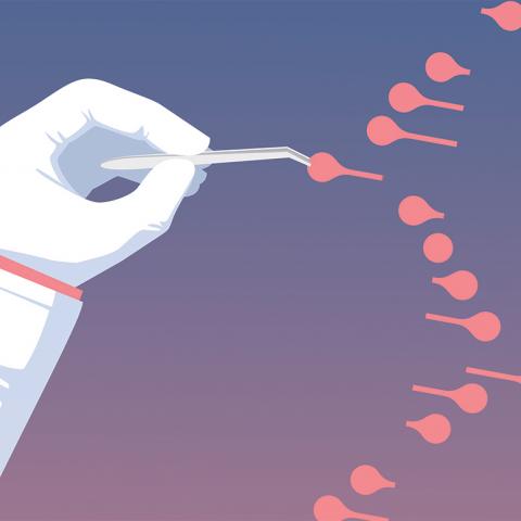 RNA editing